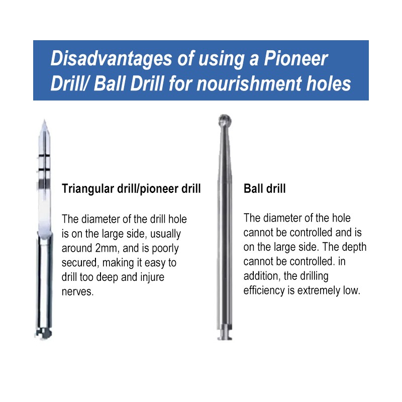 Dental Nutrient Drill Bone Increment Nutrient Hole Drills Tack GBR Pilot Drills