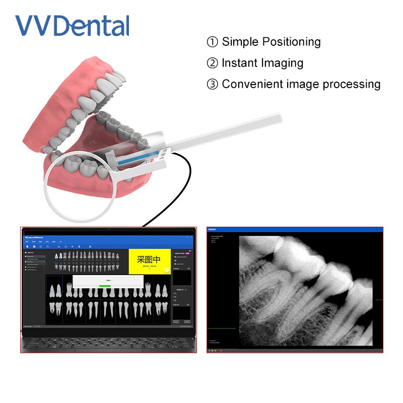 Dental Sensor Radiovisiograph Digital Sensor Intraoral Imaging System HD Image
