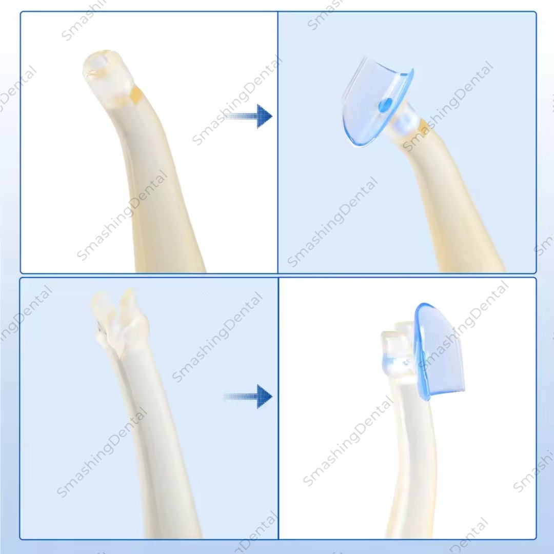 Dental Matrix Blue Transparent Cervical Matrices Composite Gingival Retractor