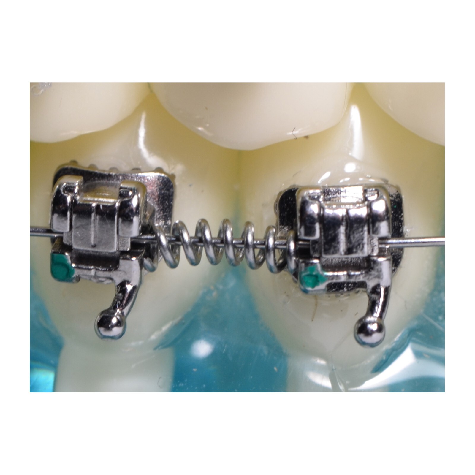 J&J Ortho™ Dental Orthodontic NiTi Open Coil Spring Optional Size