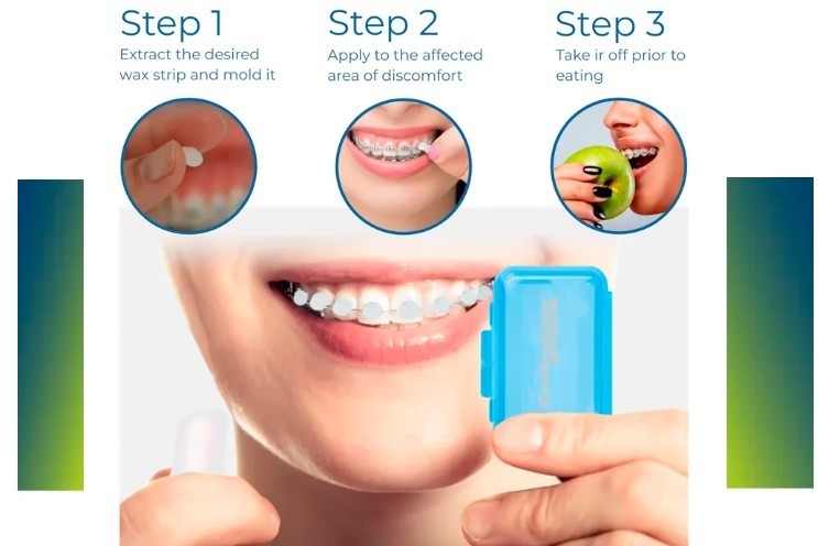COLDENTCARE Set x 50 boxes Orthodo Braces Wax Light Mint Scent COLDENTCARE