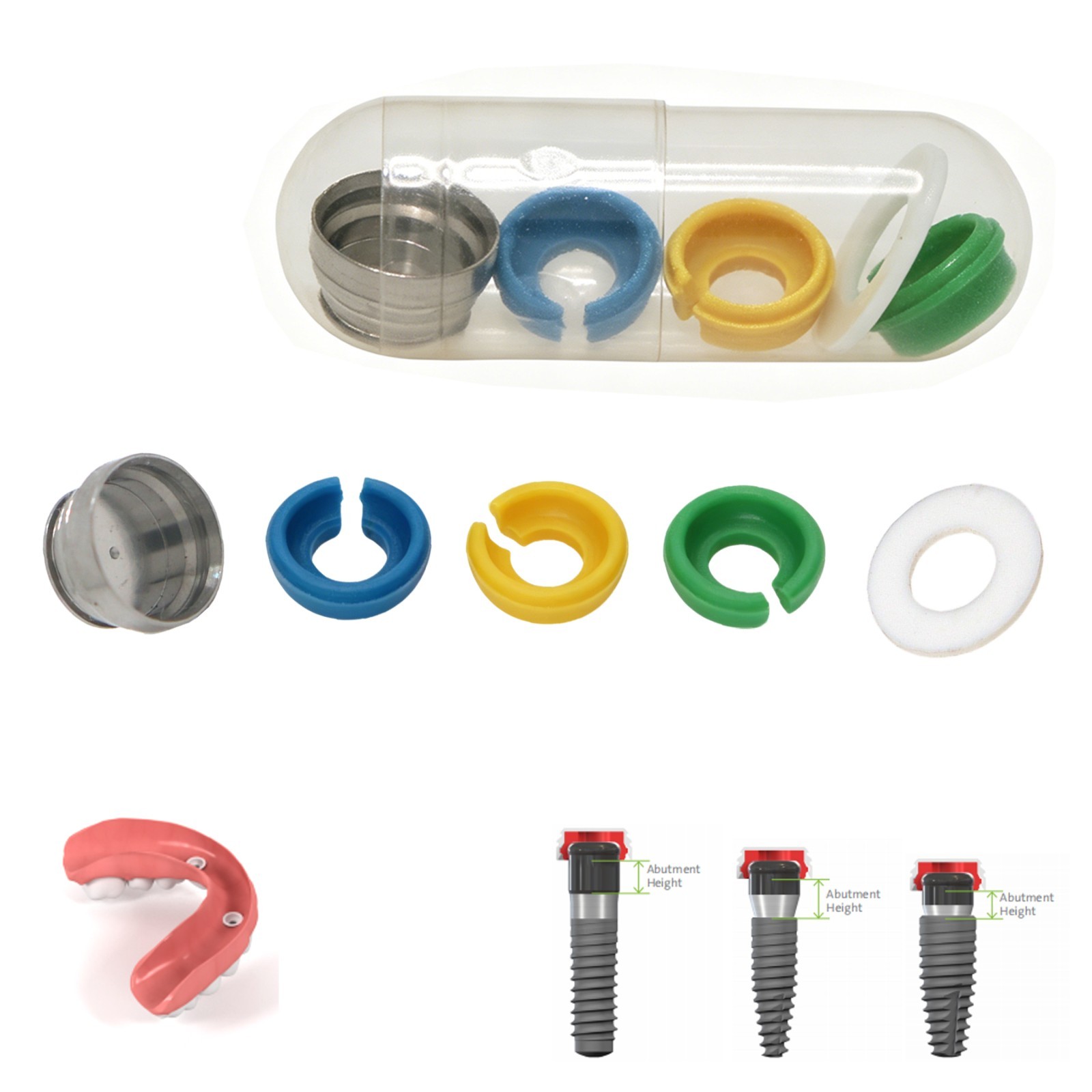 Dental Overdenture Retention Inserts Implant Overdenture Accessories for Novaloc