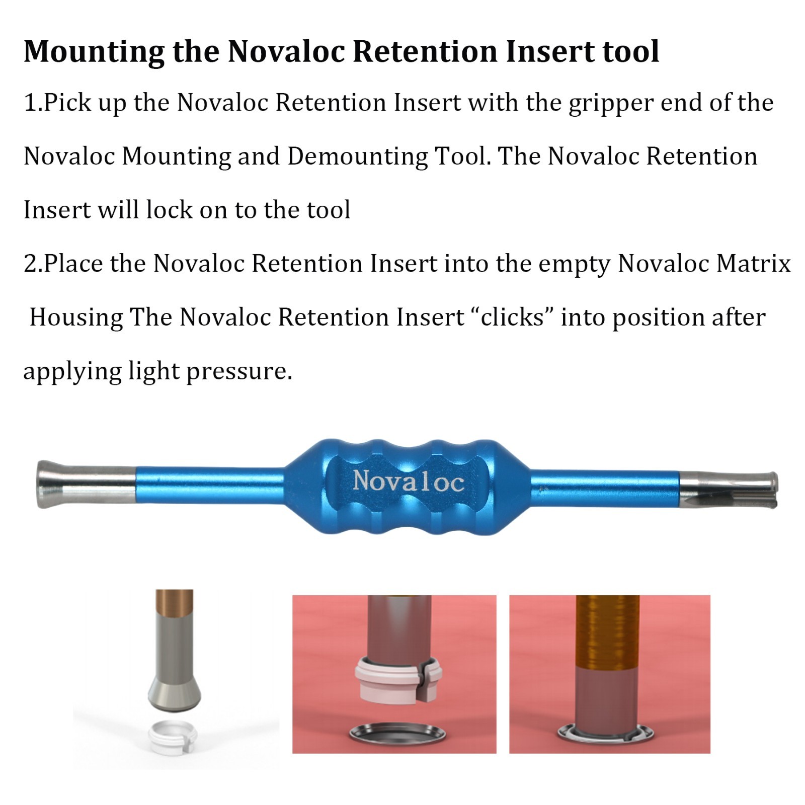 US Dental Locator Overdenture Male Caps Novaloc Retention Inserts Cap Core Tool