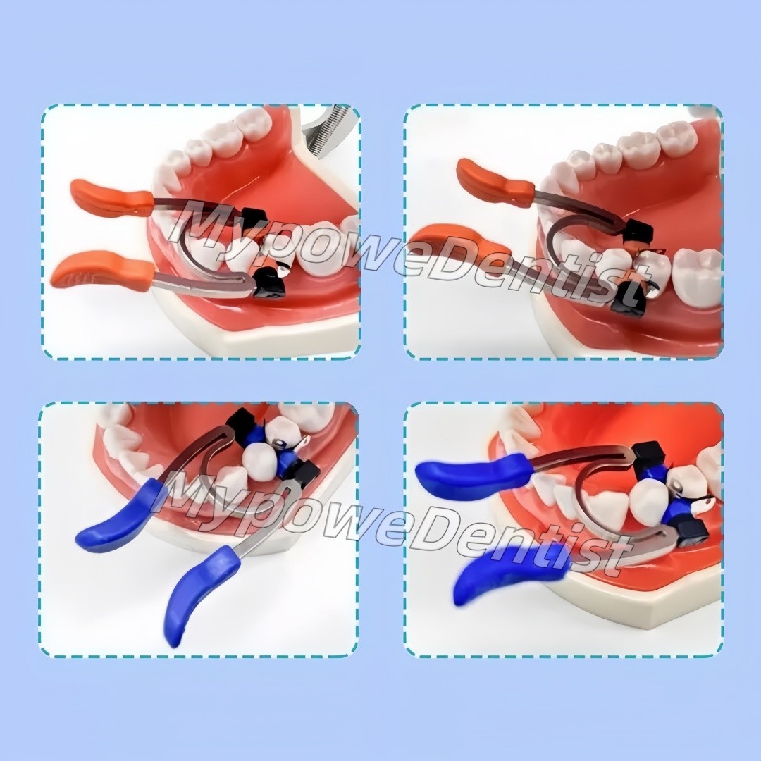 Dental Matrix Band Ring Sectional Matrice Clamp Fit Garrison R5 2.0/R8 1.0