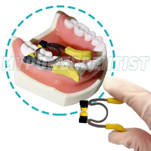 Dental Matrix Band Ring Sectional Matrice Clamp Fit Garrison R5 2.0/R8 1.0