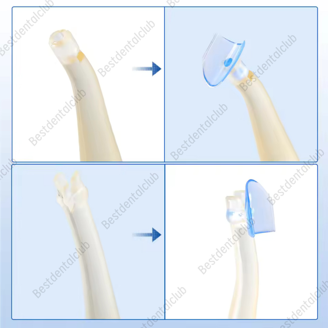 Dental Blue Transparent Cervical Matrices Composite Gingival Retractor Matrix