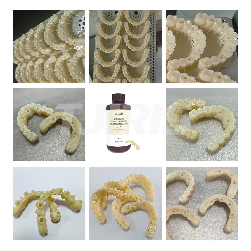 Dental Temporary Crown Bridge 3D Printing Resin Bleached Flexible Resin 1kg