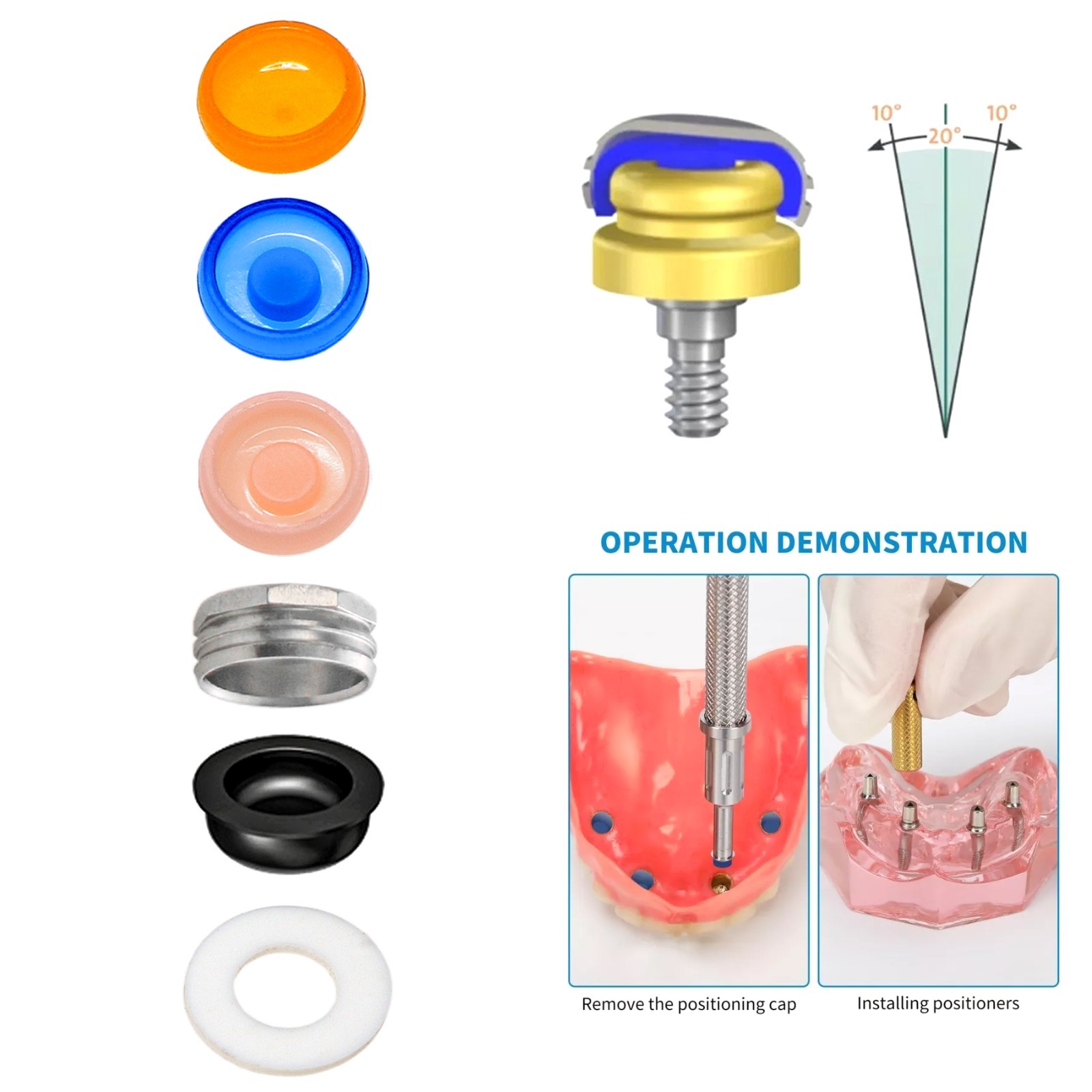 US Overdenture Dental Locator Abutment Retention Caps 1.2/2.4lbs Metal Housing