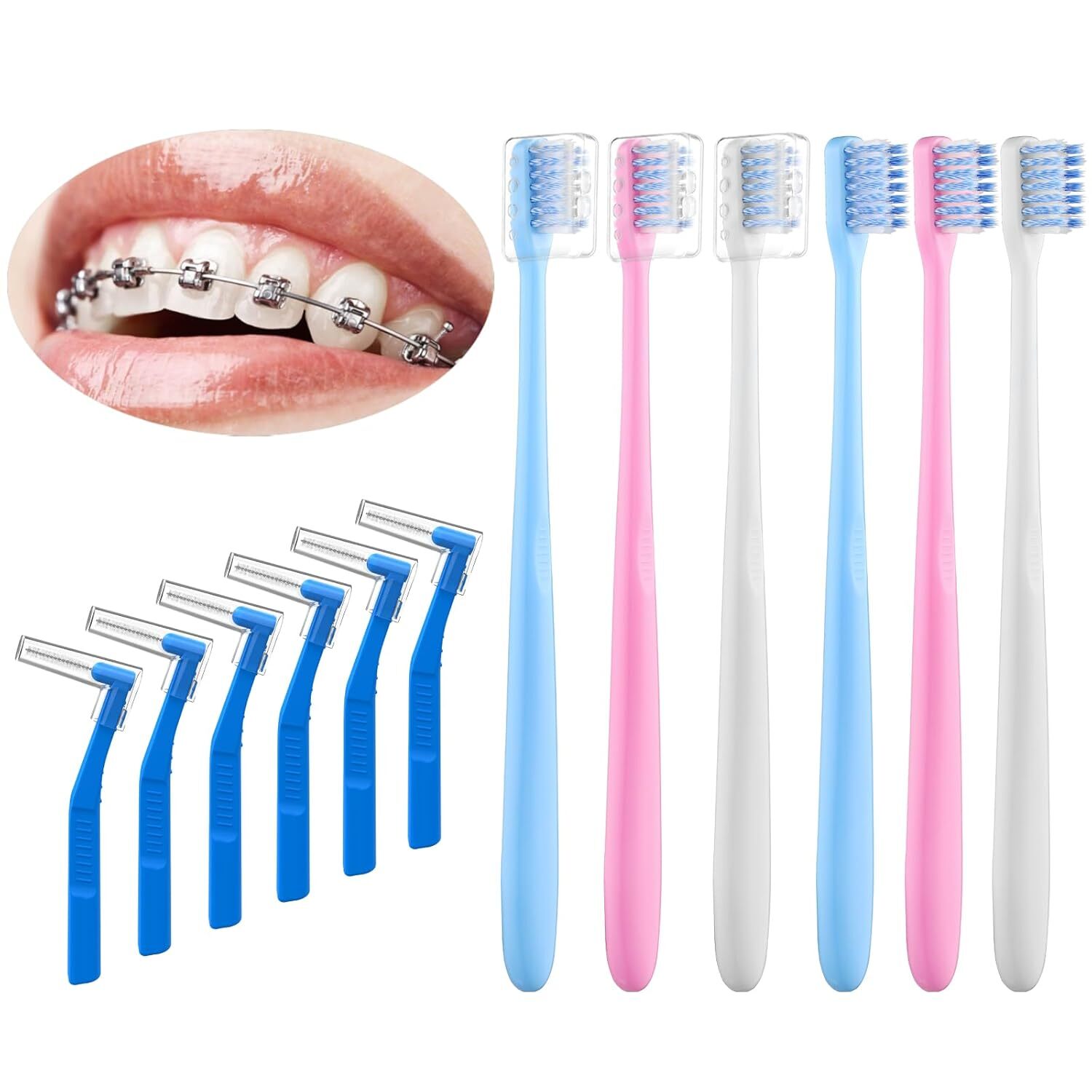 V-Shaped Orthodontic Toothbrush for Braces, Soft Bristles, 6 Count, with…