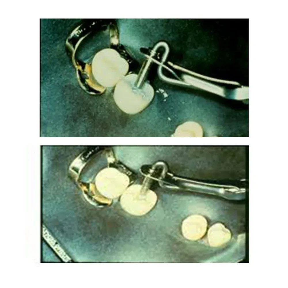 GDC Amalgam Carrier Double Ended Jumbo Regular (AC5203)