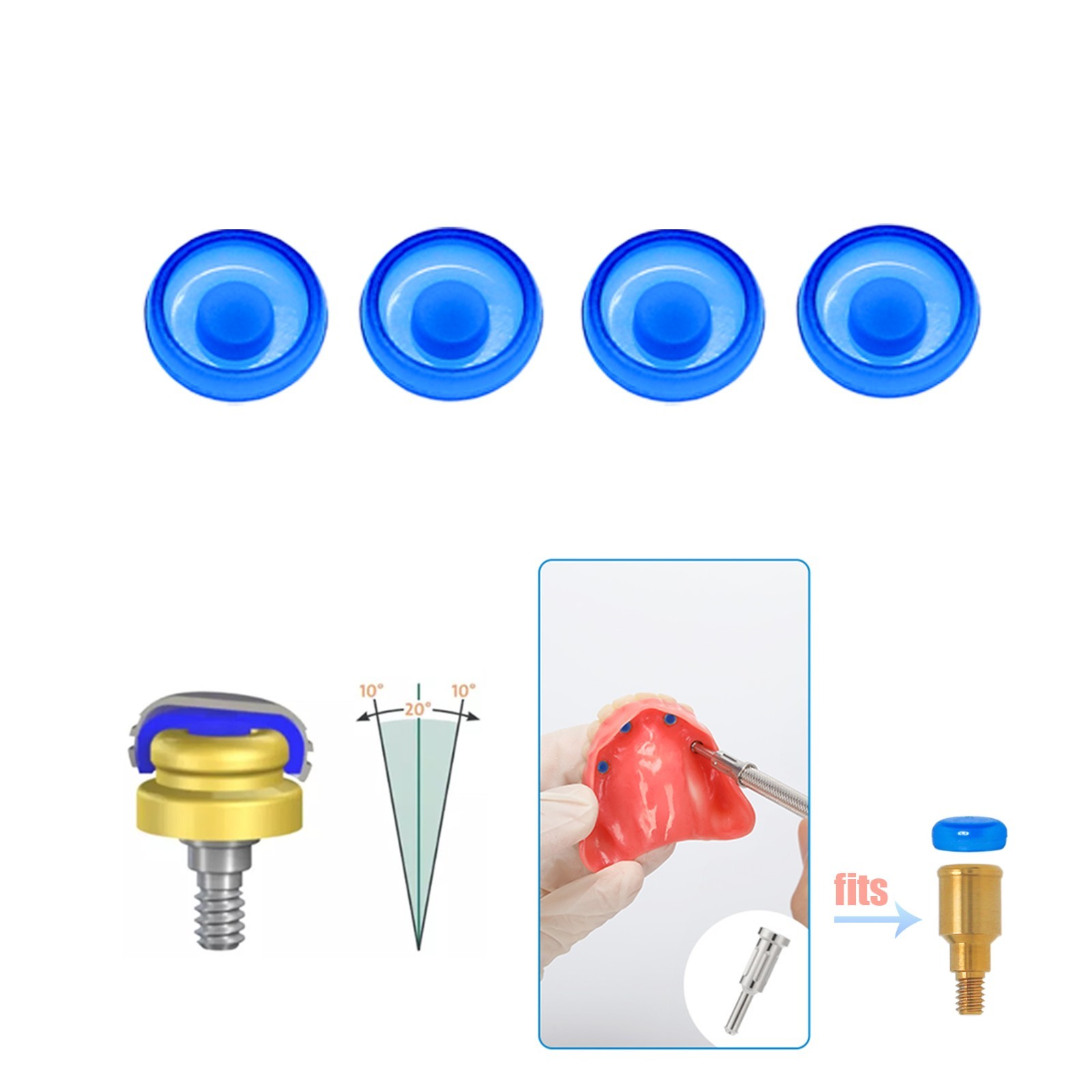 US Dental Zest Locator Classic PEEK Retention Inserts Male Caps for Overdenture