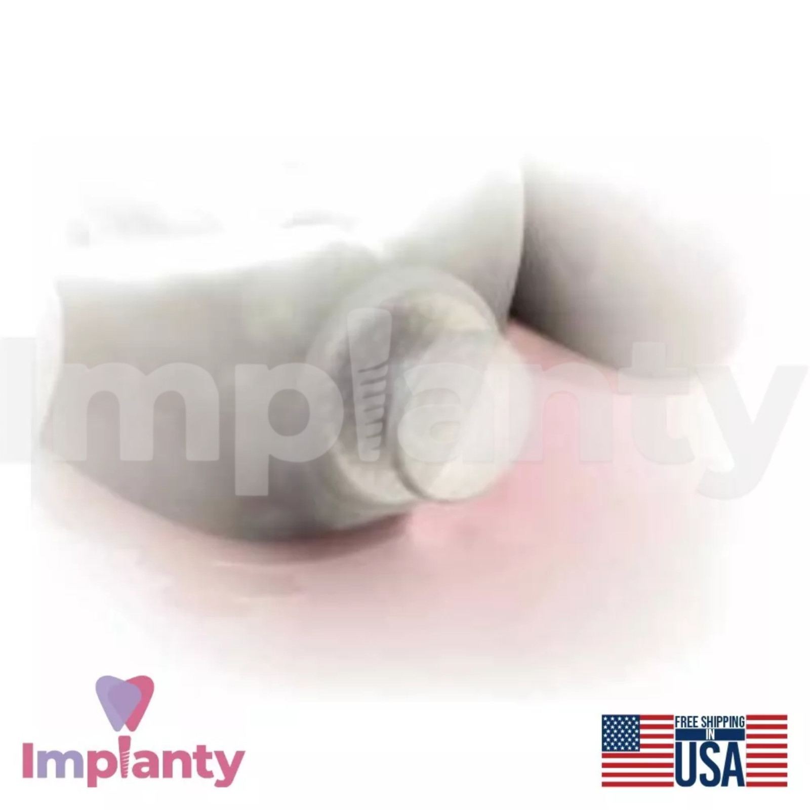 10x Morelli Dental C0mposite Lingual Buttons Ø2.9mm Diameter Aesthetic White