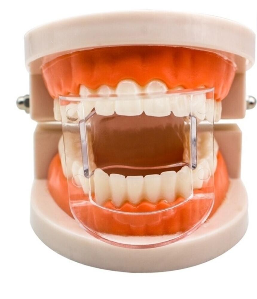 NEW 10 X Dental Mouth Gag Opener Teeth Props Retractor Cheek Expander