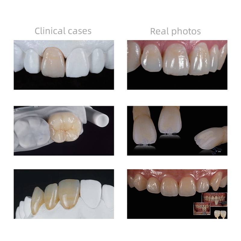 5Pcs Dental Glass Ceramic C14 Low Transparency CAD/CAM Lithium Dissilicate Block