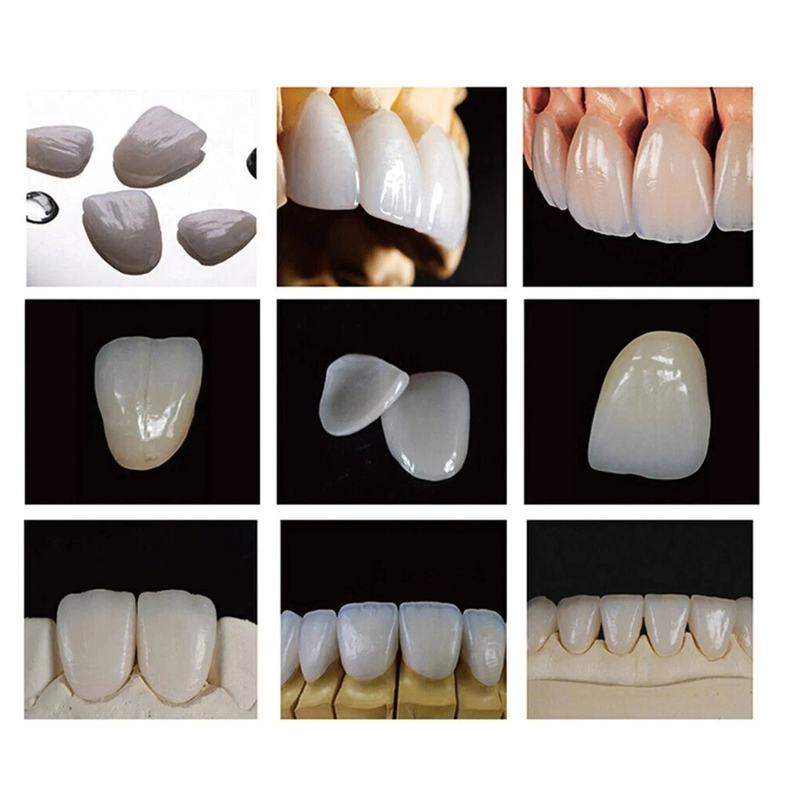US HT C14 Emax Dental Glass Ceramic Lithium Dislicate CAD/CAM Cerec Blocks