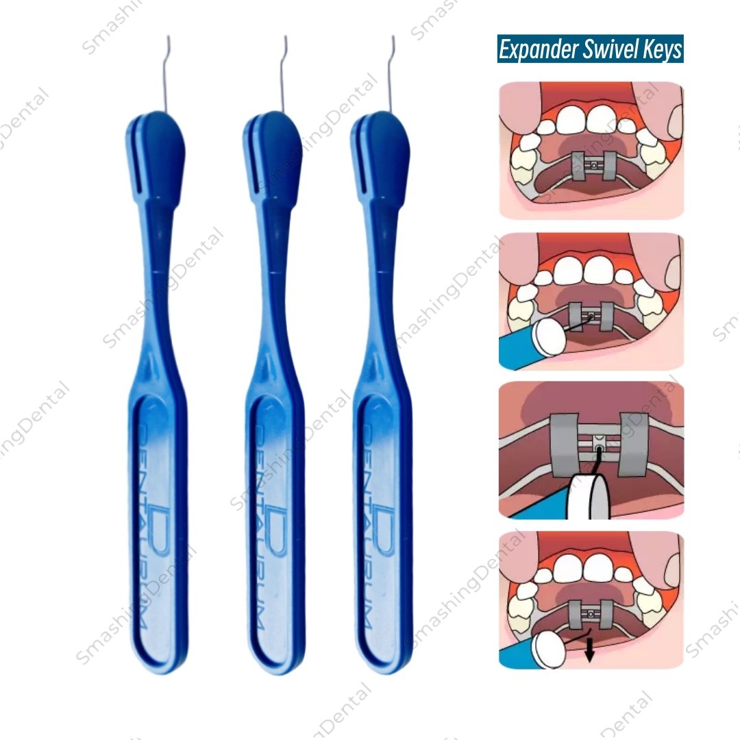 Orthodontic Dental Expansion Screw Blue Rapid Palatal Expander Tool Swivel Keys