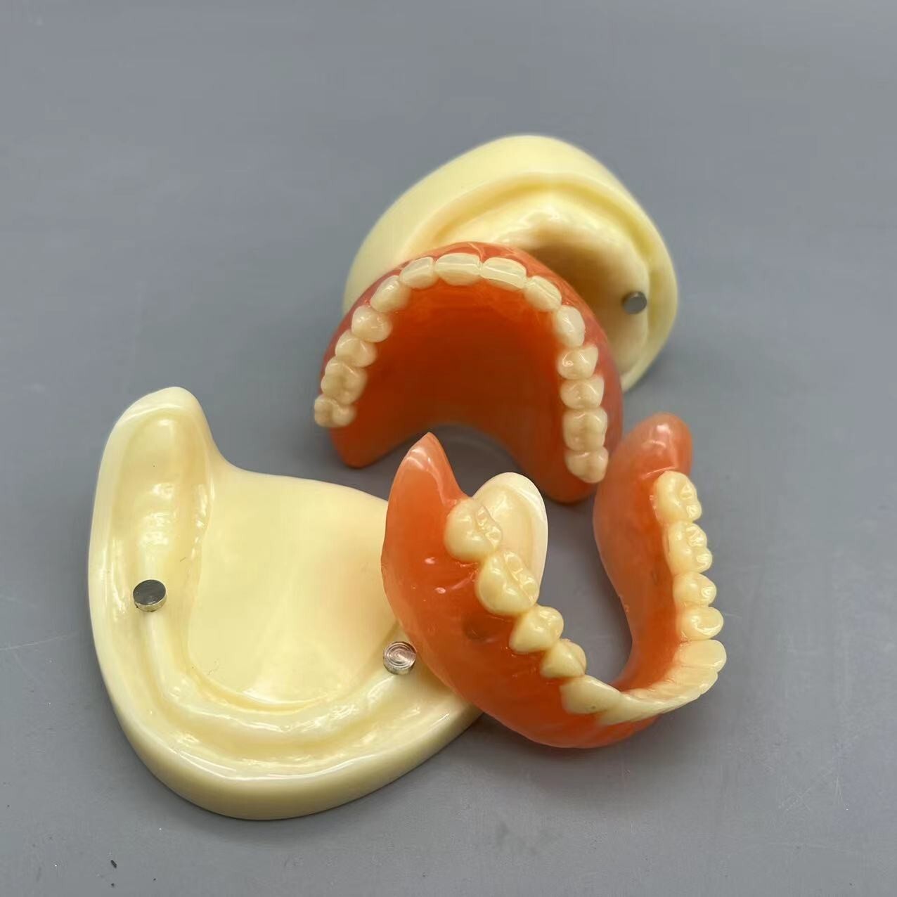 Dental 2 Implants Overdenture Typodont Restoration Upper Lower Lower Teeth Model