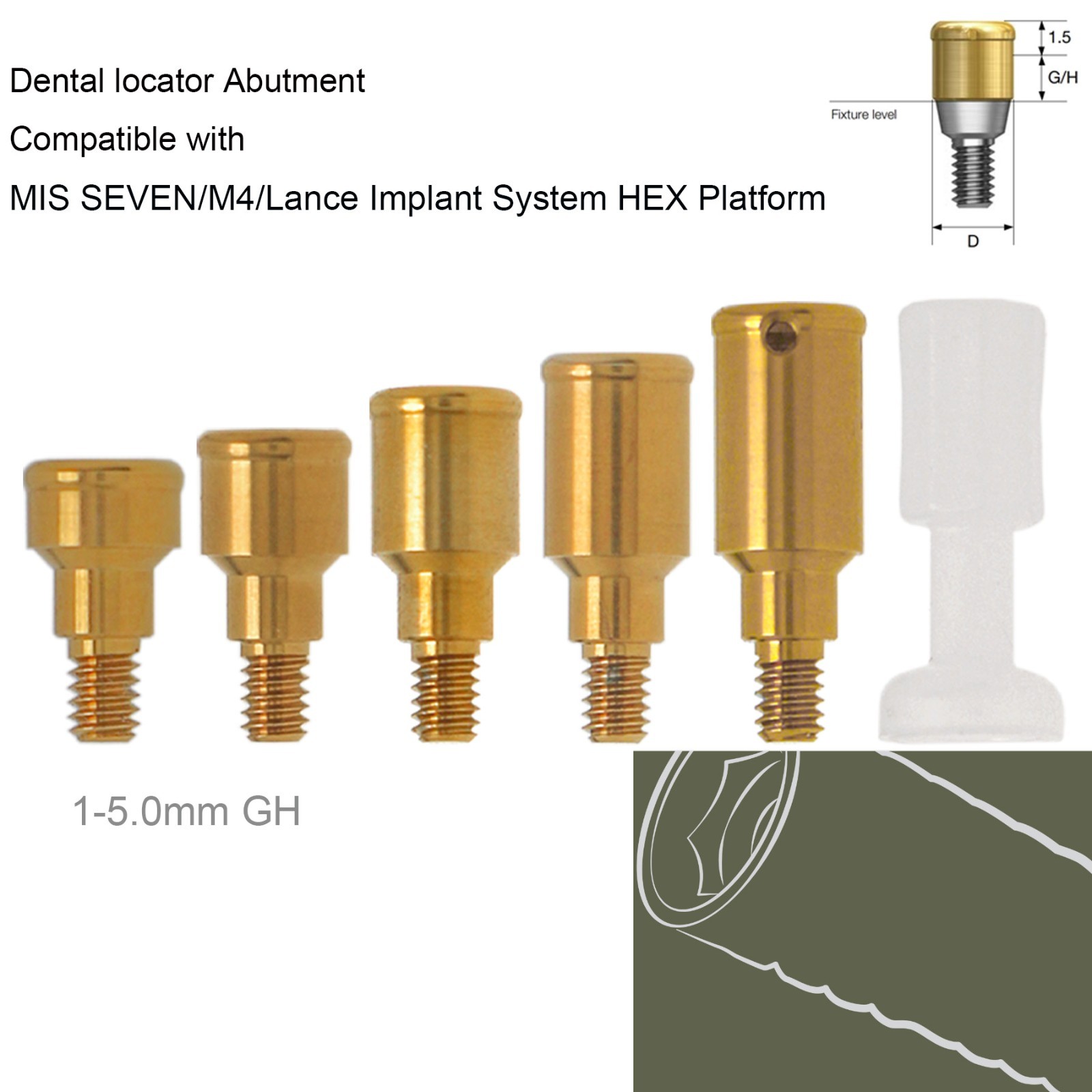 US Dental Locator abutment Overdentrue Male Caps Inserts Fits ALL Implant System