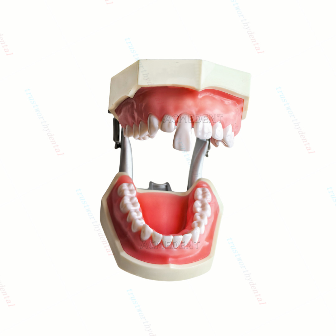Dental Typodont Model with Removable Teeth M8011 DP 32 Demonstration Teach Study
