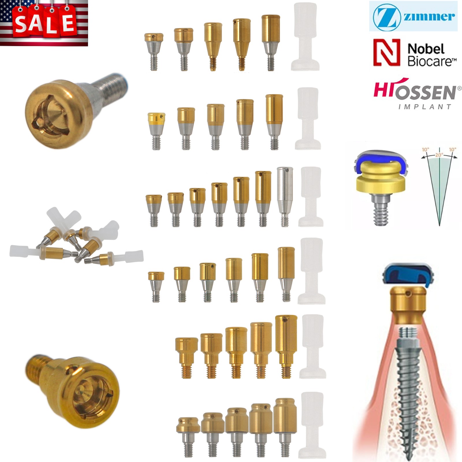 Locator Abutment Overdenture Fits for Nobel/Hiossen/Adin/Zimmer TSV/MIS Platform