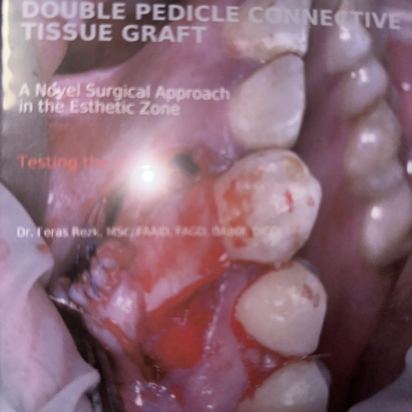5 Dental education surgical DVD for dental implants training