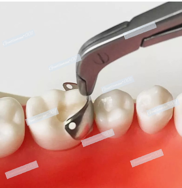 Dental Matrix Bands Sectional Wedges Twezeer Plier Garrison Palodent V3 System