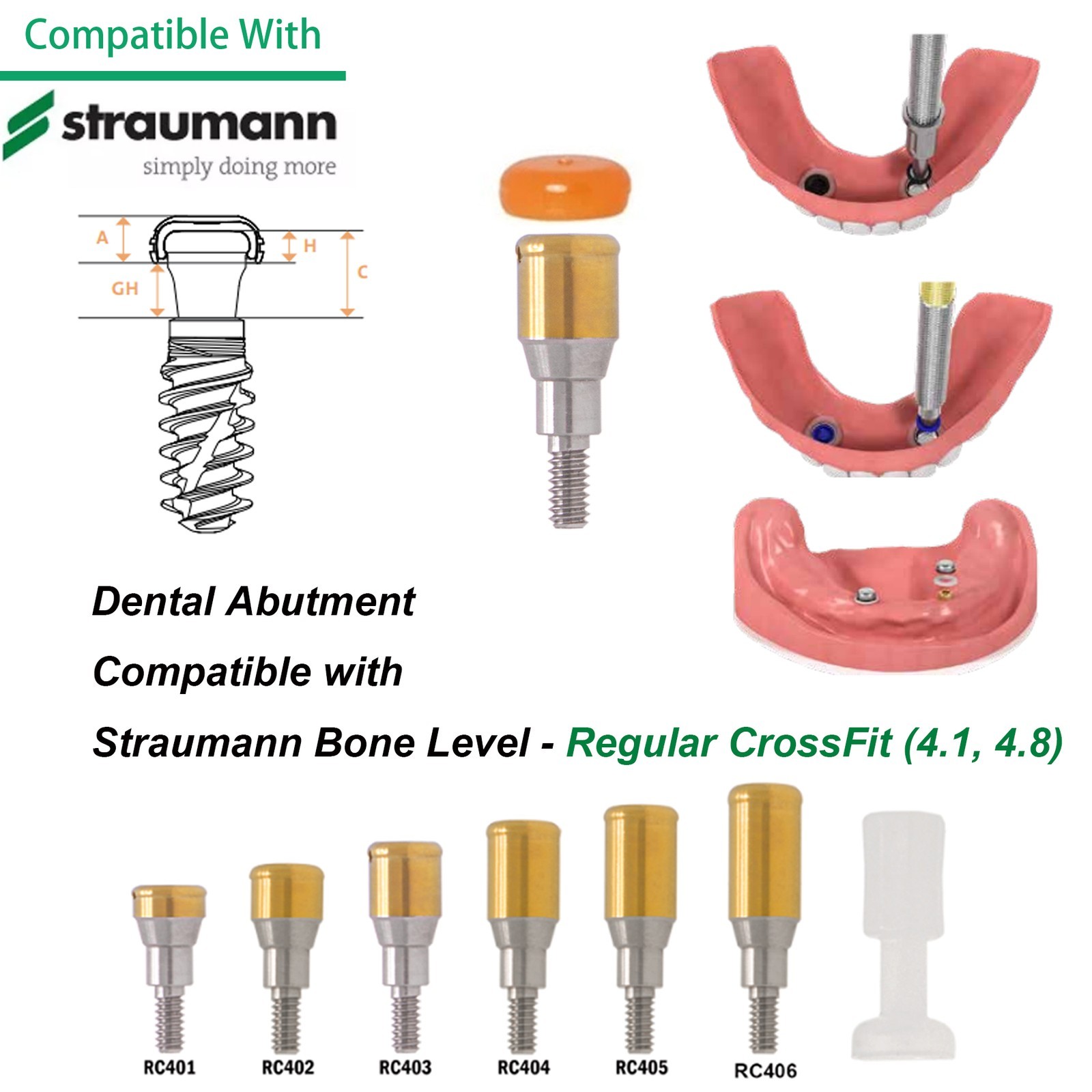 ZEST Legacy Locator Overdenture Abutment Hiossen Nobel Straumann Zimmer Neodent