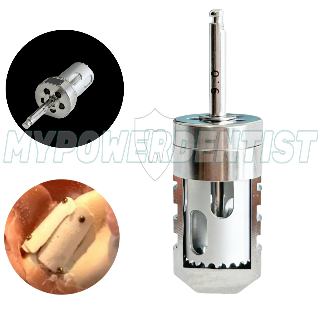 Dental SLT Half Moon Harvest Drill Semilunar Technique Collector Drills