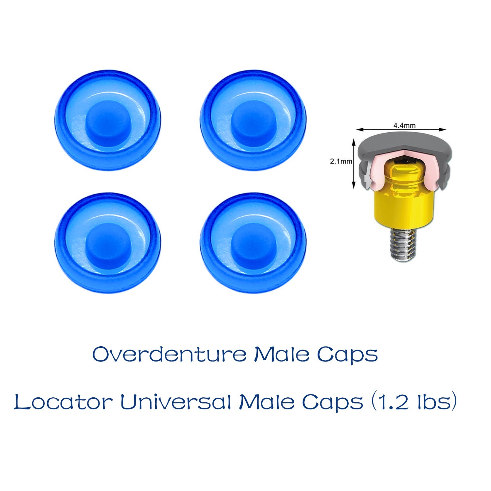 Dental Locator Abutment Male Cap Inserts for ZIMMER TSV 3.5 Adin Mis Hex Implant