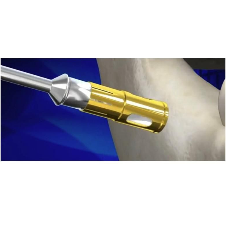 1pcs Dental Surgident NLBC Never Loss Bone Collector Kit Surg ical Tool