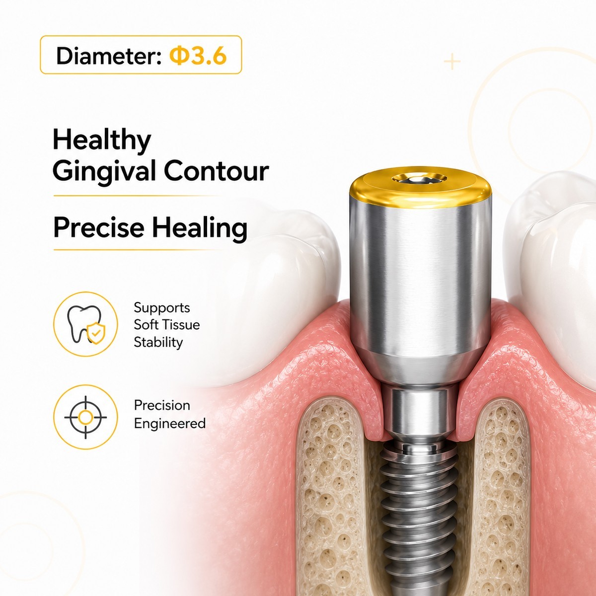 US Nobel Biocare Titanium Healing Abutment NP RP Internal Conical ∅3.6/5.0/6.0mm