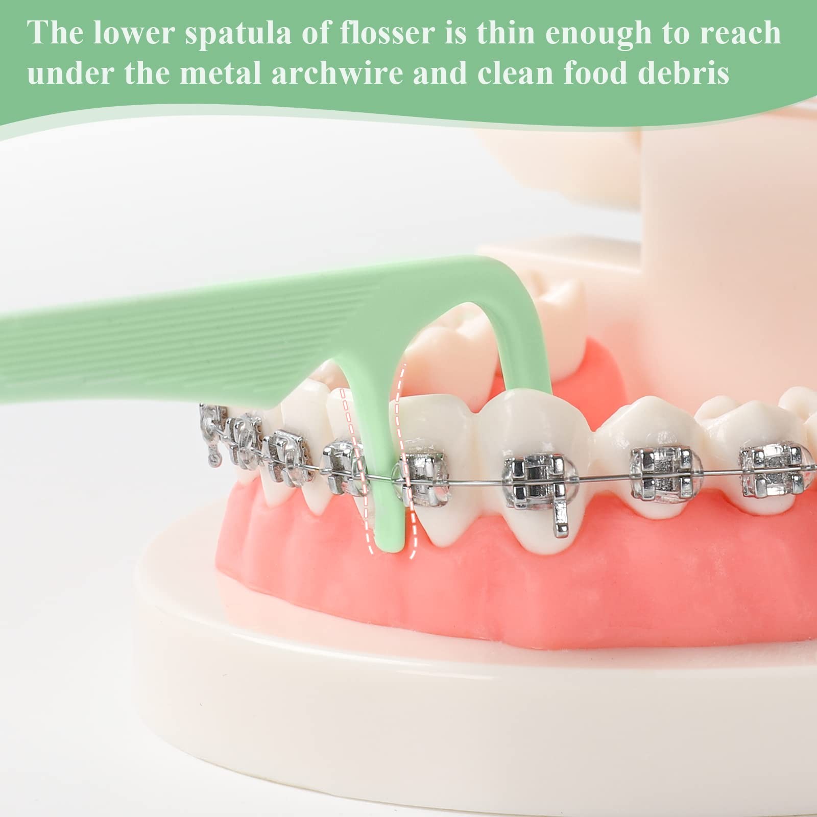 150 Count Orthodontic Flossers for Braces with 1 (Pack of 150), Green