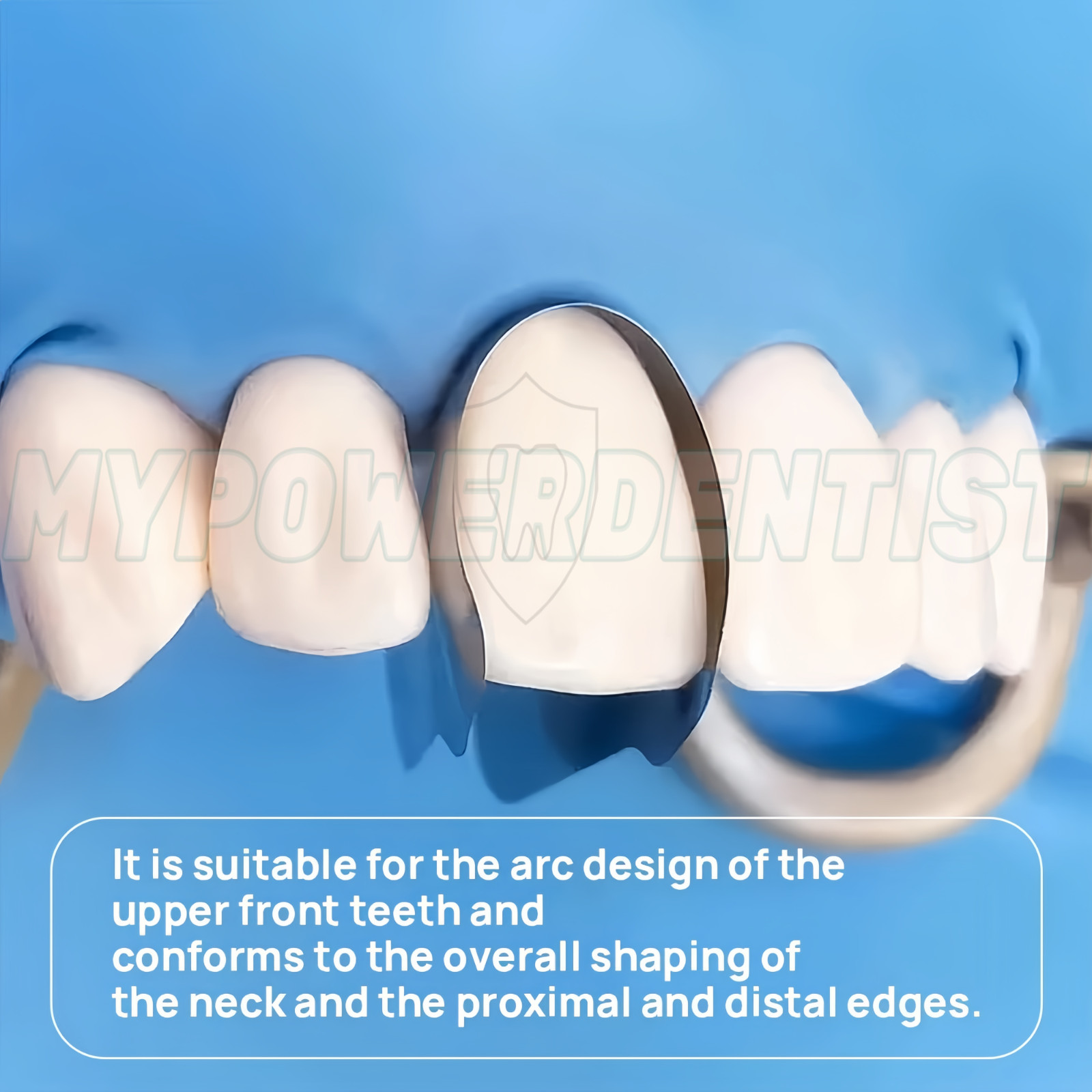 Dental Contoured Anterior Metal Matrix Bands Restoration Sectional M/S Matrices