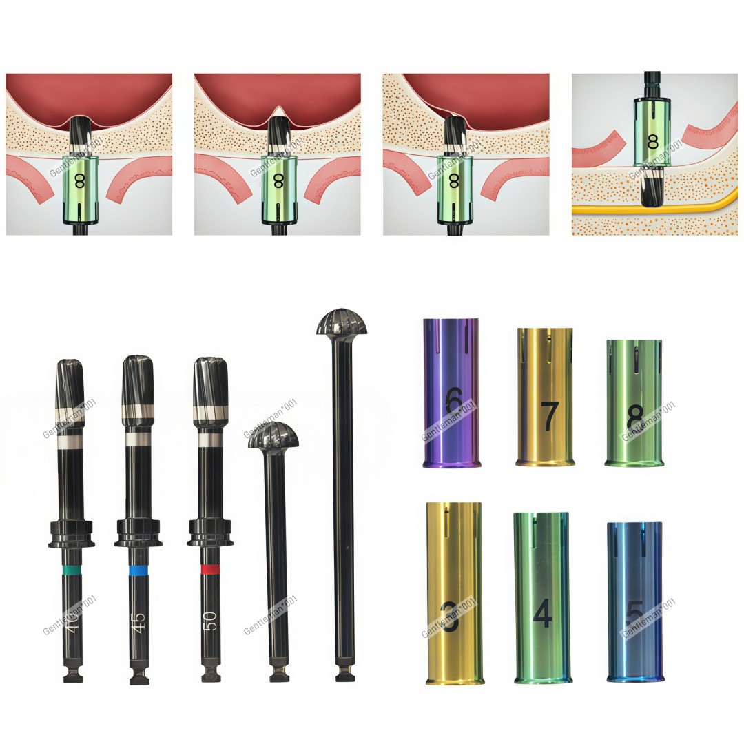 Dental DLC Lift Drills Reamer Stoppers Crestal Drill Bit Sleeve