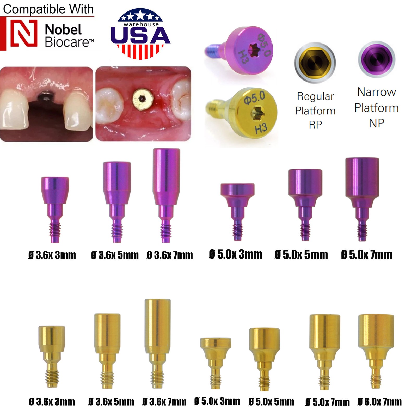 US Nobel Biocare Locator/Healing Abutment NP/RP Retention Caps Inserts Scanbody