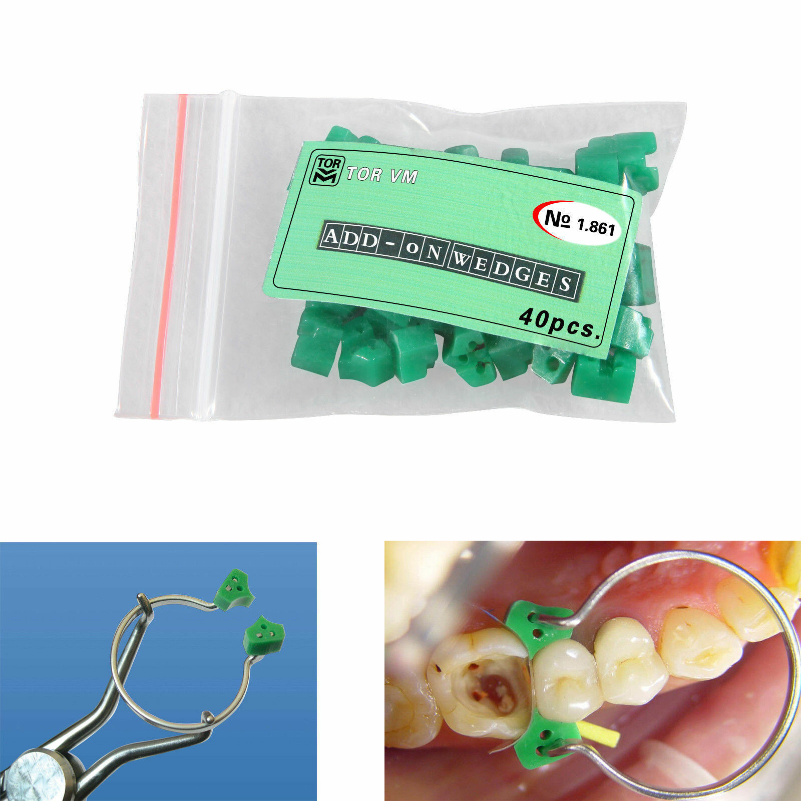 40 Pcs Dental Silicon Orthodontics Autoclavable Silicon Rubber Elastic Matrix
