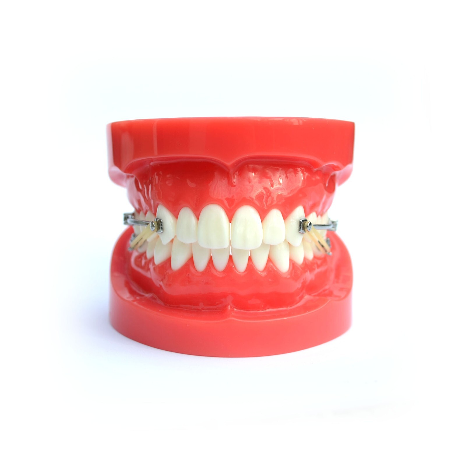 J&J Ortho™ BiteForce™ Orthodontic Bondable Distalizing Bar Appliance (2/pair)