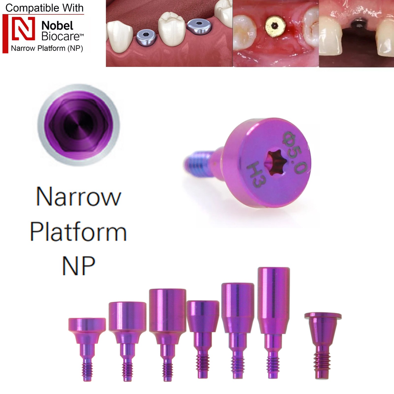 US Nobel Biocare Implant Healing Abutment Cap Titanium NP RP CC Temporary Dental