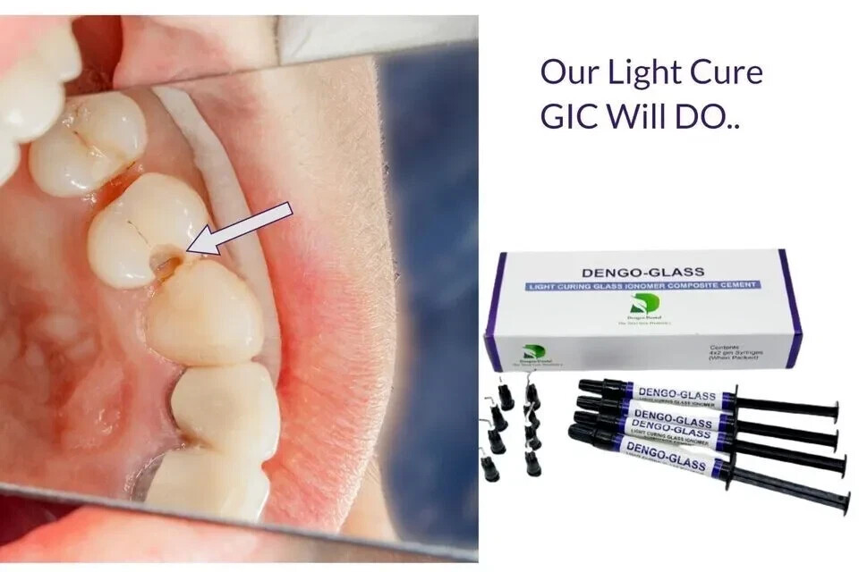 Dental DENGEN Flow Resin Light Cure Composite Flow Resin Nano Hybrid 4x2g
