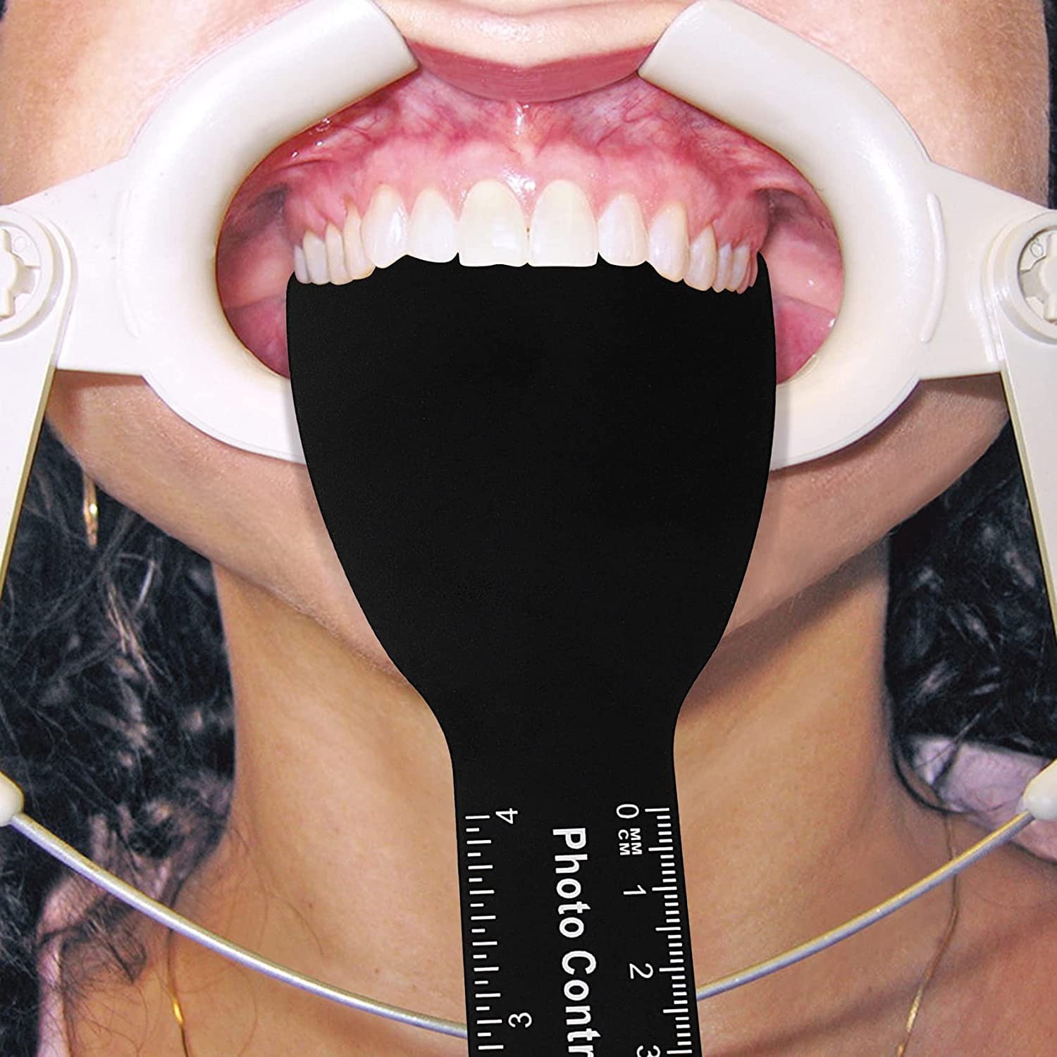 PROTECTOR 6 Pcs Dental Contraster Intraoral Photographic Black…