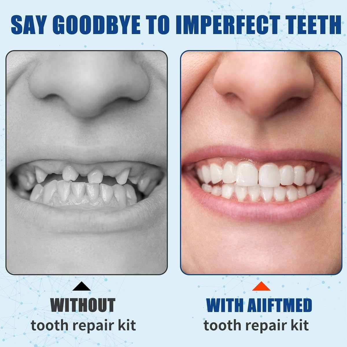 Effective Temporary Tooth Repair Kit – Zinc Oxide for Affordable Smiles – 2PCS