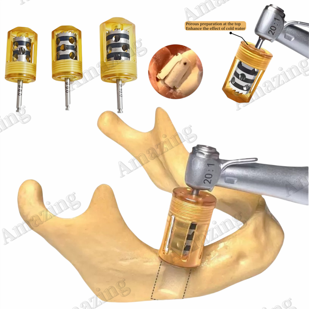 Dental Slice Collector Drill Harvest Half Month Sheet-like Drilling SLT GBR