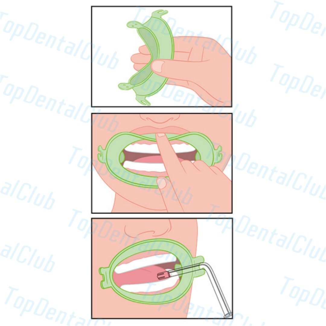 SML Dental Mouth Opener Lip Cheek Retractors Soft Optragate Fixable Tube Holder