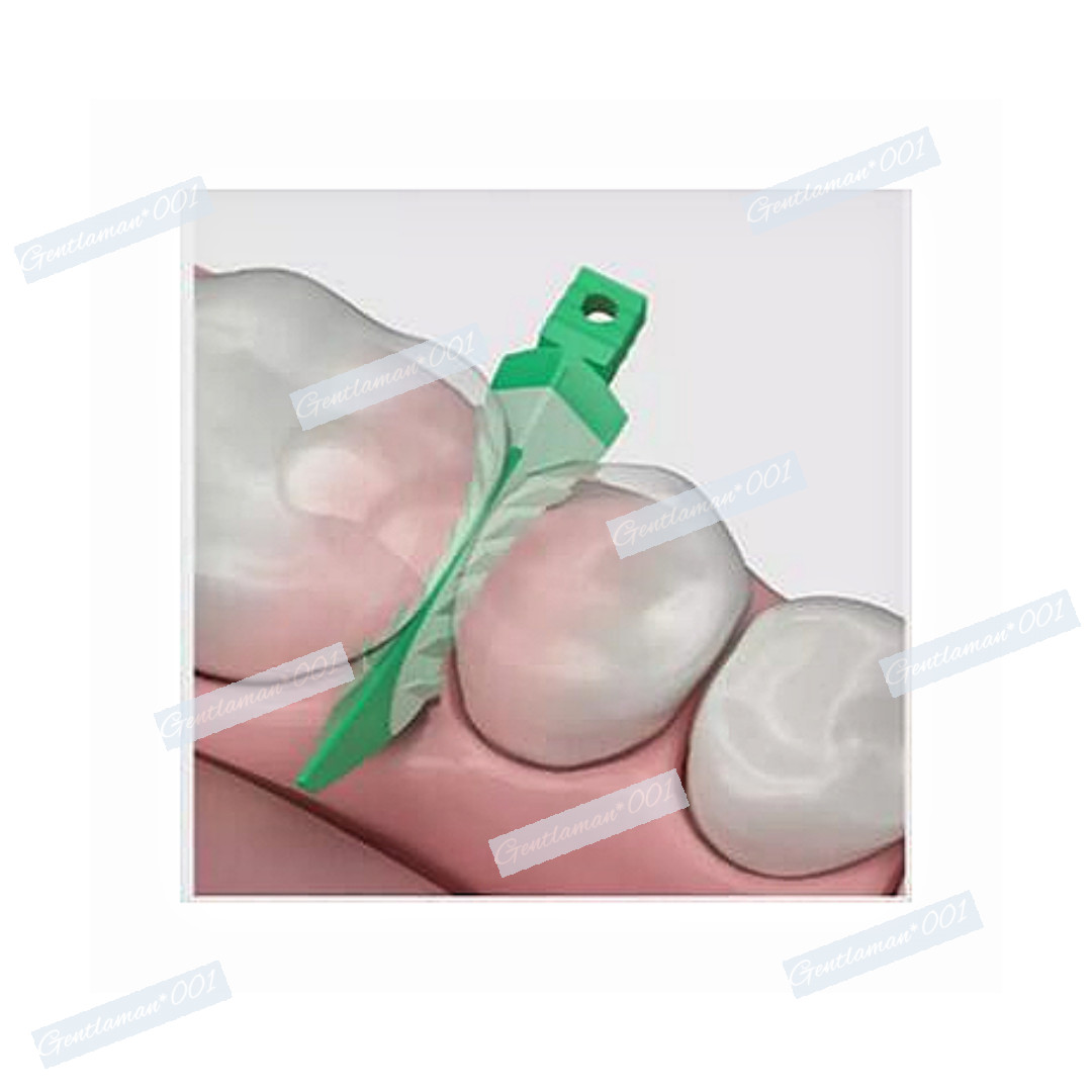Dental Matrix Bands Sectional Wedges Twezeer Plier Garrison Palodent V3 System