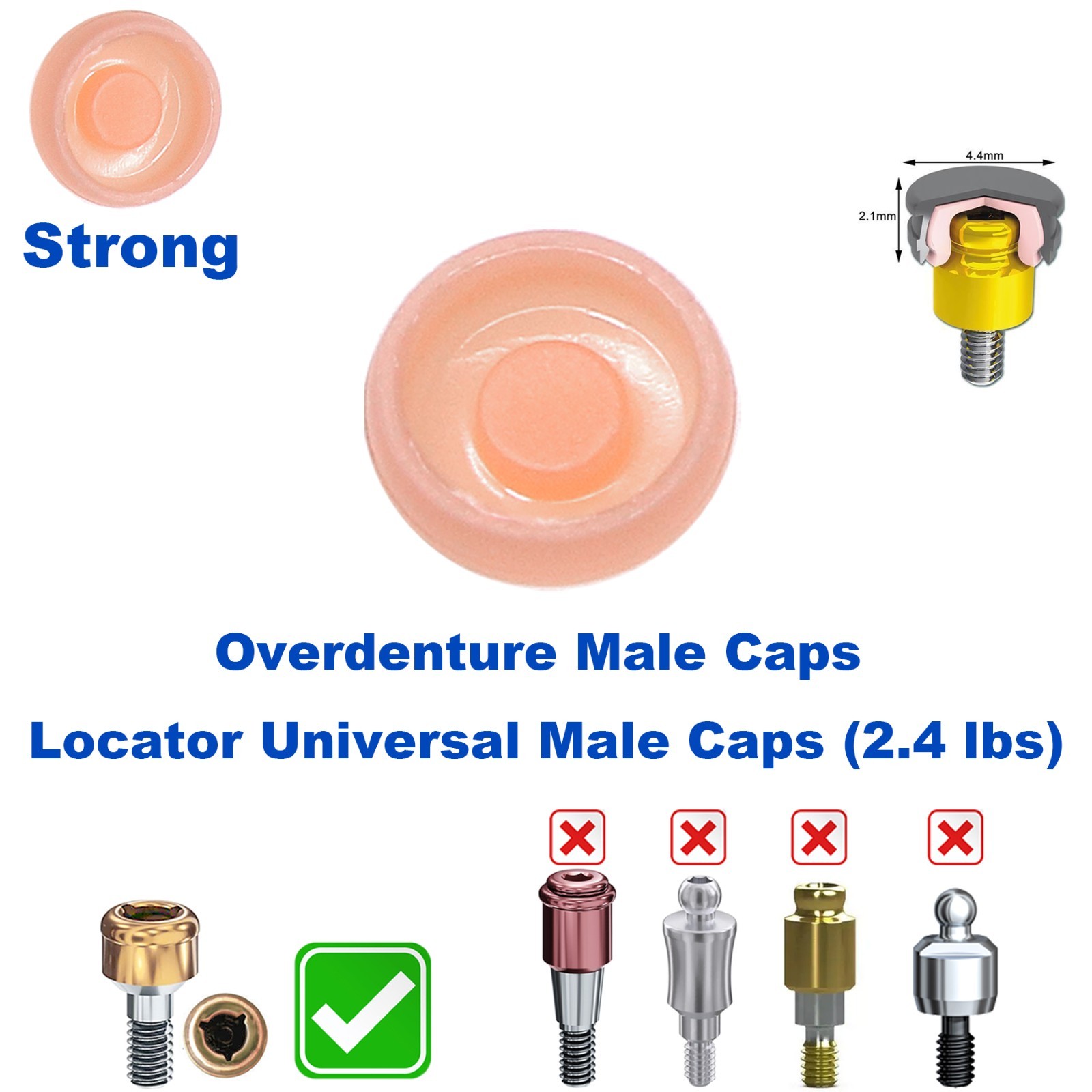 US 5Pcs Dental Overdenture Locator Abutments Retention Caps For Implant Inserts