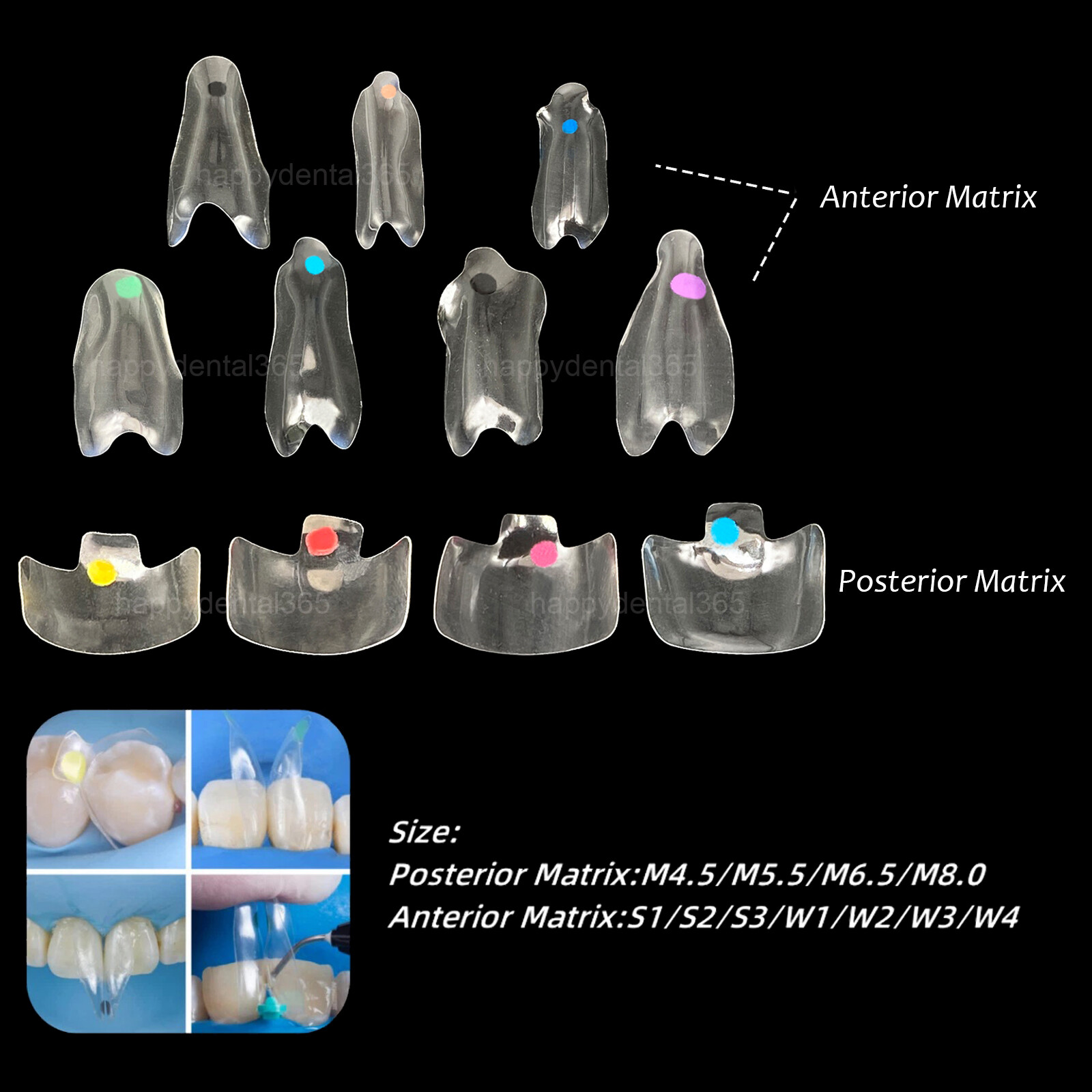 Clear Matrix Dental Anterior Posterior Transparent BT Matrices Fit BioClear