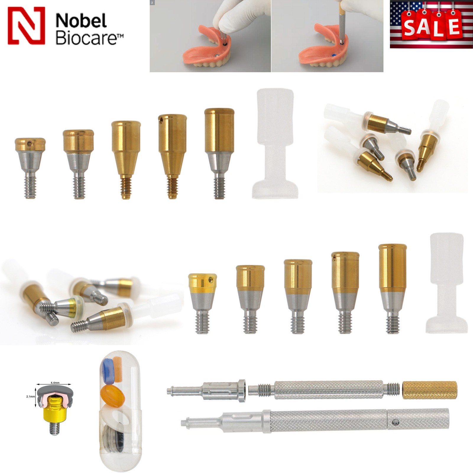 Locator Abutment Overdenture Fits for Nobel/Hiossen/Adin/Zimmer TSV/MIS Platform