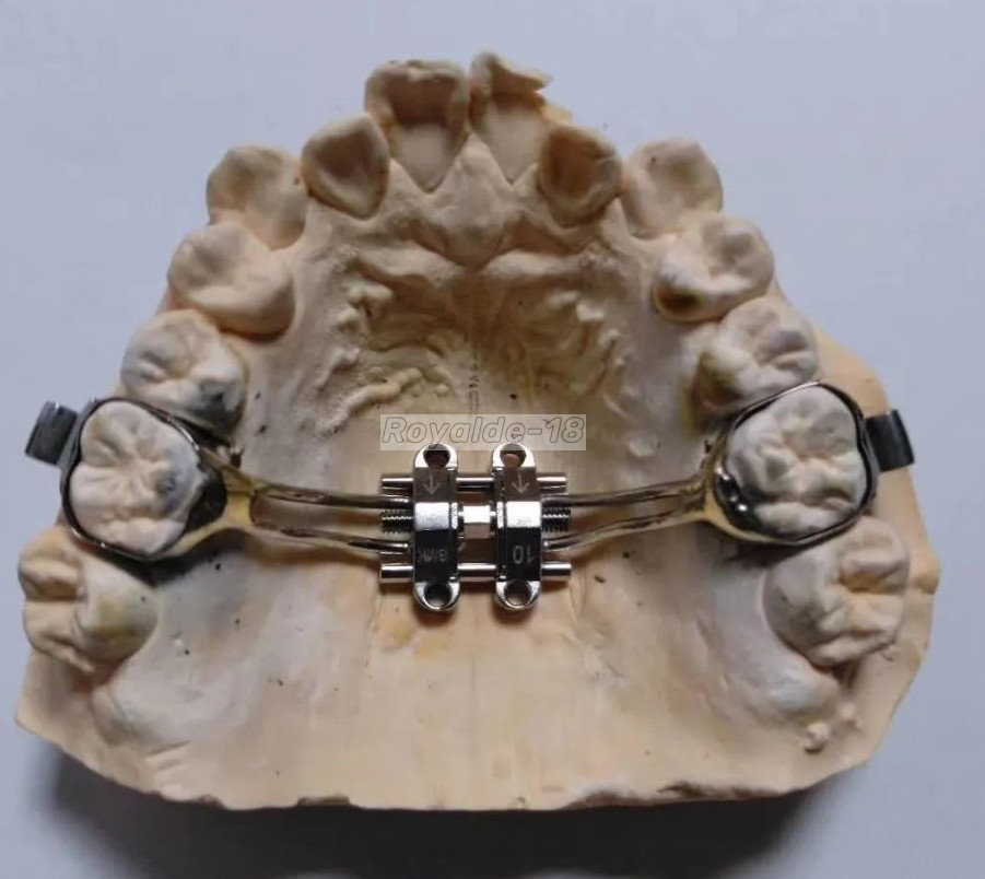 MSE Dental Palatal Expander Orthopaedic Mid Facial Parallel Expansion Screw Rod