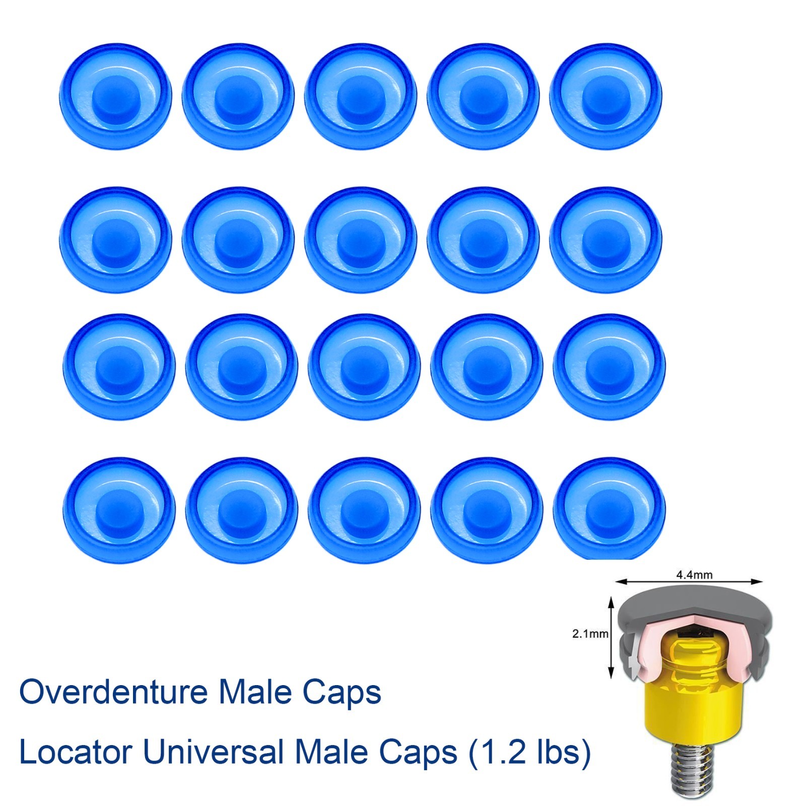 US Dental fits Zest Locator Replace Male Cap Inserts Standard Blue 1.2lbs 20Pcs