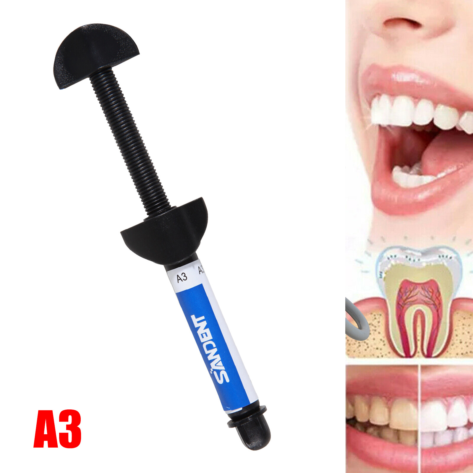 Dent Light Cure Hybrid Composite Dental Resin Shade A3 -4.5 g syringe 001-001 OR